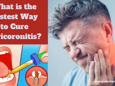 Pericoronitis Treatment