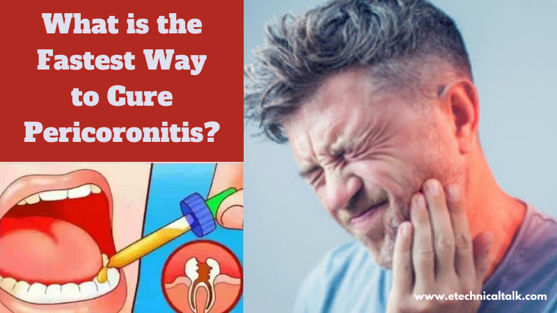 Pericoronitis Treatment