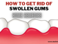 swollen gums