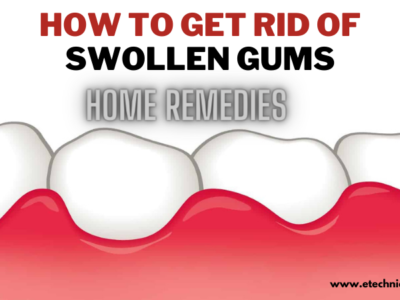 swollen gums