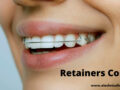 Retainers Cost
