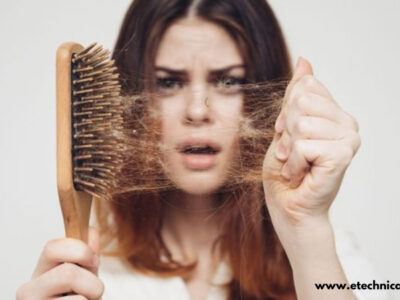 postpartum hair loss